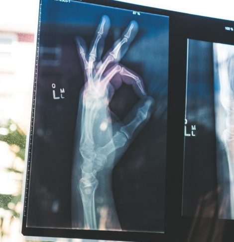 Zakład Diagnostyki Radiologicznej Zdjęcie rtg